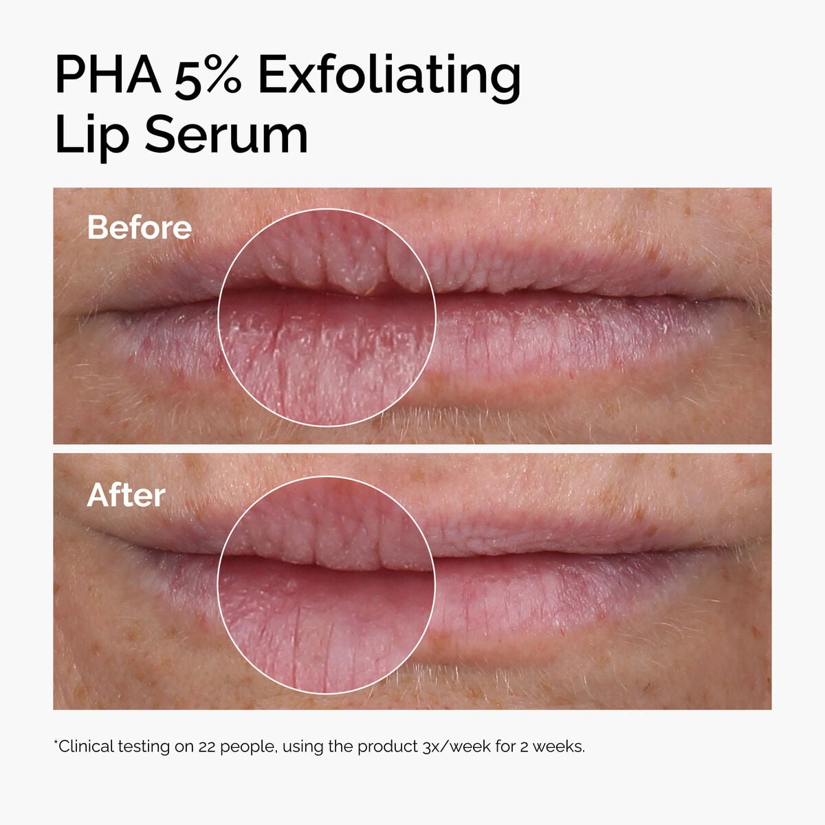 pha-5-exfoliating-lip-serum-t4 ord-pha-5pct-lip-exfoliating-serum-before-after.jpg